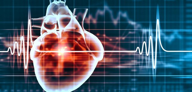 هوش مصنوعی مرگ ناشی از ایست قلبی را پیش‌بینی کرد