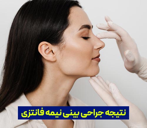 نتیجه جراحی بینی نیمه فانتزی